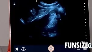 Ultra sound in detail surcease - dr wolf, austin