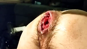 Just fisting my amoral cleft together with prolapse:)