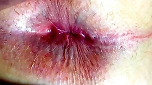 Ass with an increment of anus closeup